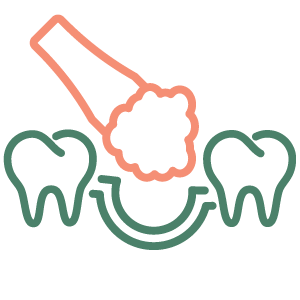 Bone Grafting