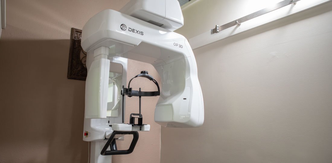 Kirkland CBCT