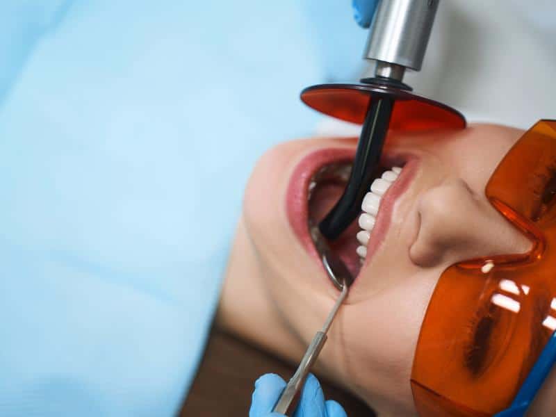 A patient getting dental bonding in Kirkland, WA, at Manson & Chi Dentistry