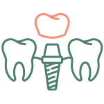 icon-mcd-dental-implants-overview.png