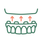 icon-mcd-services-all-on-4-dental-implants.png