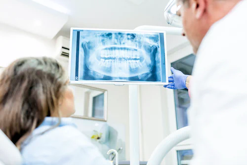 Digital Dental X-Rays available at Manson & Chi Dentistry in Kirkland, WA